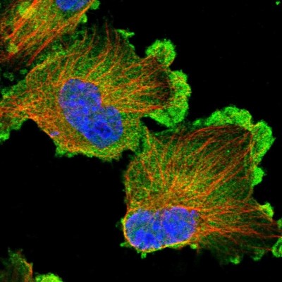 Immunocytochemistry/Immunofluorescence: ELKS Antibody [NBP1-88178] - Immunofluorescent staining of human cell line U-251 MG shows localization to plasma membrane & cytosol.