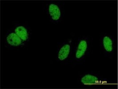 Immunocytochemistry/Immunofluorescence: PHIP Antibody (4D7) [H00055023-M01] - Analysis of monoclonal antibody to PHIP on HeLa cell. Antibody concentration 10 ug/ml.