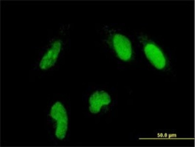 Immunocytochemistry/Immunofluorescence: GLTSCR2 Antibody (5A8) [H00029997-M03] - Analysis of monoclonal antibody to GLTSCR2 on HeLa cell. Antibody concentration 10 ug/ml
