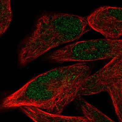 Immunocytochemistry/Immunofluorescence: PRDM12 Antibody [NBP1-85829] - Immunofluorescent staining of human cell line RH-30 shows localization to nucleus.