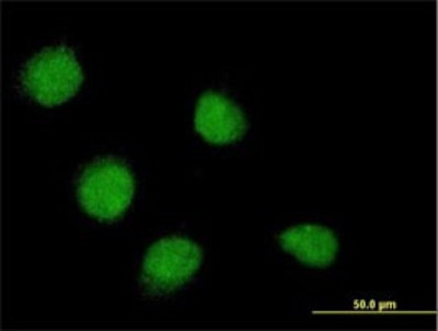 Immunocytochemistry/Immunofluorescence: SSX4 Antibody (3E10) [H00006759-M02] - Analysis of monoclonal antibody to SSX4 on HeLa cell. Antibody concentration 10 ug/ml.