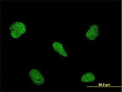 Immunocytochemistry/Immunofluorescence: RBM5 Antibody (2B6) [H00010181-M01] - Analysis of monoclonal antibody to RBM5 on HeLa cell. Antibody concentration 10 ug/ml.