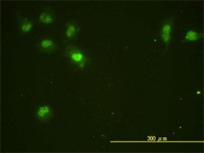 Immunocytochemistry/Immunofluorescence: CDC2L5 Antibody (1B3-1B11) [H00008621-M01] - Analysis of monoclonal antibody to CDC2L5 on HeLa cell. Antibody concentration 10 ug/ml.