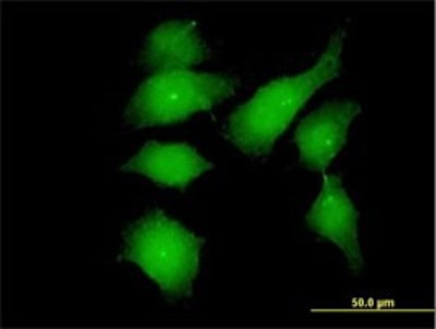 Immunocytochemistry/Immunofluorescence: FGFR1OP Antibody (2B1) [H00011116-M01] - Analysis of monoclonal antibody to FGFR1OP on HeLa cell. Antibody concentration 10 ug/ml.