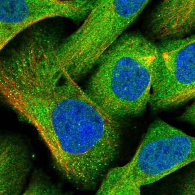 Immunocytochemistry/Immunofluorescence: EXOC6 Antibody [NBP1-85031] - Staining of human cell line U-2 OS shows positivity in cytoplasm, vesicles and centrosome.