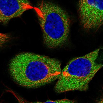 Immunocytochemistry/Immunofluorescence: EPRS Antibody [NBP1-84929] - Immunofluorescent staining of human cell line U-2 OS shows localization to cytosol.