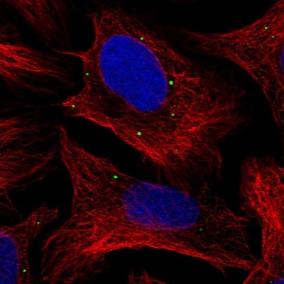 Immunocytochemistry/Immunofluorescence: ADP-Sugar Pyrophosphatase/NUDT5 Antibody [NBP1-83131] - Immunofluorescent staining of human cell line U-2 OS shows localization to vesicles.