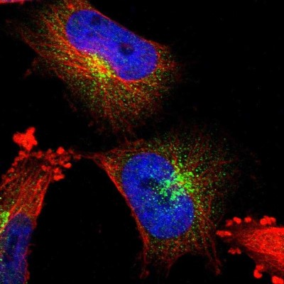Immunocytochemistry/Immunofluorescence: DPPII/QPP/DPP7 Antibody [NBP1-84986] - Immunofluorescent staining of human cell line U-251 MG shows localization to the Golgi apparatus & vesicles.