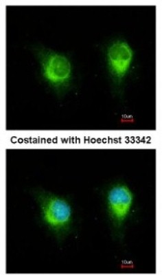 Immunocytochemistry/Immunofluorescence: kinectin Antibody [NBP2-15003] - Analysis of methanol-fixed HeLa, using antibody at 1:200 dilution.