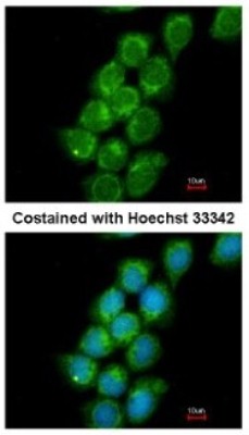 Immunocytochemistry/Immunofluorescence: PRC1 Antibody [NBP2-19925] - Analysis of methanol-fixed A431, using antibody at 1:200 dilution.
