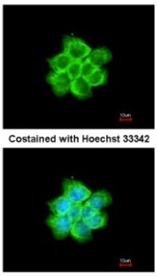 Immunocytochemistry/Immunofluorescence: Tubulin Beta 2C Antibody [NBP2-14886] - Analysis of methanol-fixed A431, using antibody at 1:200 dilution.