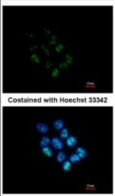 Immunocytochemistry/Immunofluorescence: WDR12 Antibody [NBP2-20888] - Immunofluorescence analysis of paraformaldehyde-fixed A431, using antibody at 1:200 dilution.
