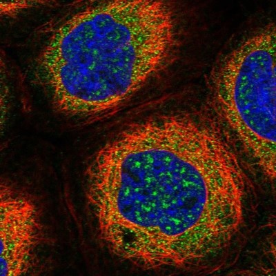 Immunocytochemistry/Immunofluorescence: RUFY1 Antibody [NBP1-83606] - Staining of human cell line A-431 shows localization to nuclear speckles & cytosol.