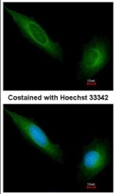 Immunocytochemistry/Immunofluorescence: JAK1 Antibody [NBP1-31815] - Analysis of methanol-fixed HeLa, using antibody at 1:200 dilution.