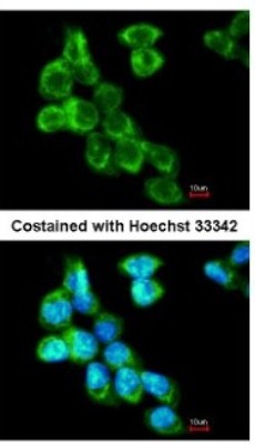 Immunocytochemistry/Immunofluorescence: COL4A3BP Antibody [NBP1-31118] - Analysis of methanol-fixed A431, using antibody at 1:200 dilution.