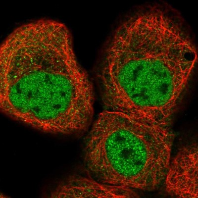 Immunocytochemistry/Immunofluorescence: KLHDC10 Antibody [NBP1-81528] - Immunofluorescent staining of human cell line A-431 shows localization to nucleoplasm.