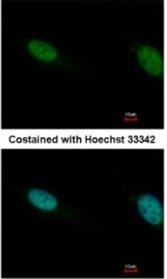 Immunocytochemistry/Immunofluorescence: BAF180/PB1 Antibody [NBP1-32025] - Paraformaldehyde-fixed HeLa, using antibody at 1:500 dilution.