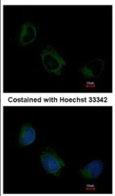 Immunocytochemistry/Immunofluorescence: EIF3F Antibody [NBP2-16299] - Immunofluorescence analysis of methanol-fixed HeLa, using antibody at 1:200 dilution.