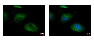 Immunocytochemistry/Immunofluorescence: FBXW11 Antibody [NBP2-16454] - HeLa cells were fixed in 4% paraformaldehyde at RT for 15 min. Green: FBXW11 protein stained by FBXW11 antibody diluted at 1:500. Blue: Hoechst 33343 staining.