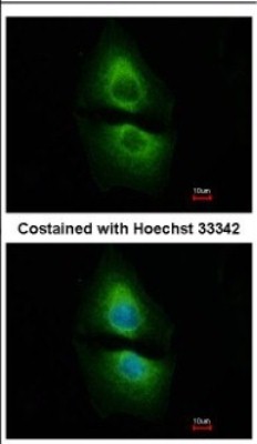 Immunocytochemistry/Immunofluorescence: PSAT1 Antibody [NBP2-19973] - Immunofluorescence analysis of methanol-fixed A549, using antibody at 1:500 dilution.