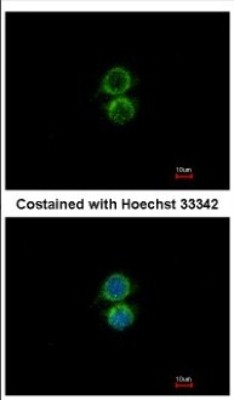 Immunocytochemistry/Immunofluorescence: PIP5K1 alpha Antibody [NBP2-19833] - Immunofluorescence analysis of methanol-fixed A549, using antibody at 1:500 dilution.