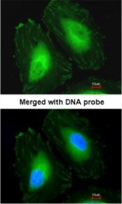 Immunocytochemistry/Immunofluorescence: CRYBA4 Antibody [NBP1-32741] - Paraformaldehyde-fixed HeLa, using antibody at 1:200 dilution.