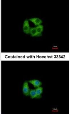 Immunocytochemistry/Immunofluorescence: PCCB Antibody [NBP1-31464] - Analysis of methanol-fixed Hep G2, using antibody at 1:500 dilution.