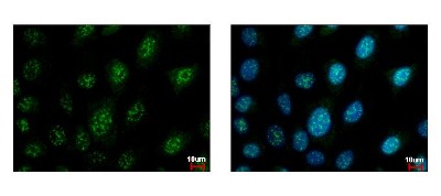 Immunocytochemistry/Immunofluorescence: BIN1 Antibody [NBP2-15587] - BIN1 antibody detects BIN1 protein at nucleus by immunofluorescent analysis. Sample: A431 cells were fixed in iced-cold MeOH for 5 min. Green: BIN1 protein stained by BIN1 antibody diluted at 1:500. Blue: Hoechst 33343 staining.