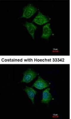 Immunocytochemistry/Immunofluorescence: POMGNT1 Antibody [NBP1-33084] - Analysis of methanol-fixed Hep3B, using antibody at 1:500 dilution.