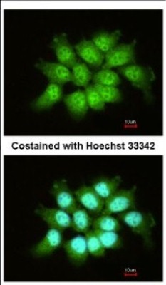 Immunocytochemistry/Immunofluorescence: THOC7 Antibody [NBP2-20622] - Immunofluorescence analysis of paraformaldehyde-fixed A431, using antibody at 1:200 dilution.