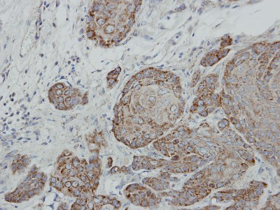 Immunohistochemistry-Paraffin: Suppressor of Fused Antibody [NBP2-20536] - Immunohistochemical analysis of paraffin-embedded Cal27 xenograft, using antibody at 1:100 dilution.