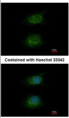 Immunocytochemistry/Immunofluorescence: HCFC1 Antibody [NBP2-16786] - Immunofluorescence analysis of methanol-fixed HeLa, using antibody at 1:200 dilution.