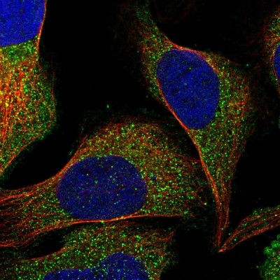 Immunocytochemistry/Immunofluorescence: RPIP8 Antibody [NBP1-80855] - Immunofluorescent staining of human cell line U-2 OS shows localization to vesicles.