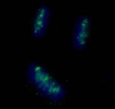 Immunocytochemistry/Immunofluorescence: CENPB Antibody [NB100-2369] - Detection of Human CENP-B by Immunocytochemistry. Samples:  NBF-fixed asynchronous HeLa cells.  Antibody:  Affinity purified rabbit anti-CENP-B (NB100-2369)  used at a dilution of 1:250.  Detection:  Anti-rabbit IgG-FITC  conjugated (NB7159) used at a dilution of 1:100.