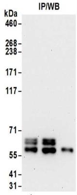 Immunoprecipitation: Ribophorin II Antibody [NBP2-32178] - Samples:  Whole cell lysate (0.5 or 1.0 mg per IP reaction; 20% of IP loaded) from HeLa cells.  Antibodies:  Affinity purified rabbit anti-Ribophorin II antibody NBP2-32178 used for IP at 6 ug per reaction. Ribophorin II was also immunoprecipitated by rabbit anti-Ribophorin II antibody BL15802.  For blotting immunoprecipitated Ribophorin II, NBP2-32178 was used at 1 ug/ml.  Detection: Chemiluminescence with an exposure time of 30 seconds.