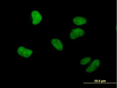 Immunocytochemistry/Immunofluorescence: WHSC1 Antibody [H00007468-B01P] - Analysis of purified antibody to WHSC1 on HeLa cell. (antibody concentration 10 ug/ml)