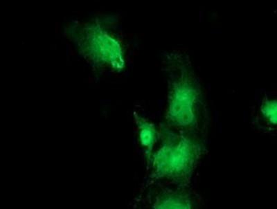 Immunocytochemistry/Immunofluorescence: Bestrophin 3 Antibody (2H3) [NBP2-03253] - Staining of COS7 cells transiently transfected by pCMV6-ENTRY Bestrophin 3.