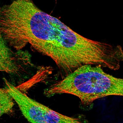 Immunocytochemistry/Immunofluorescence: ZCCHV Antibody [NBP1-92607] - Immunofluorescent staining of human cell line U-251 MG shows localization to cytosol & the Golgi apparatus.