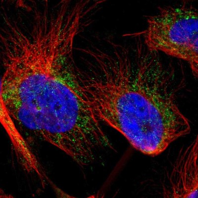 Immunocytochemistry/Immunofluorescence: SLC25A31 Antibody [NBP1-89074] - Immunofluorescent staining of human cell line U-251 MG shows localization to mitochondria.