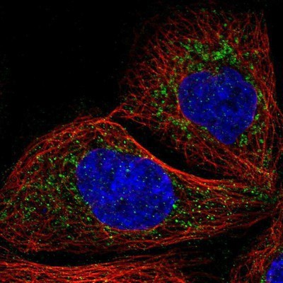 Immunocytochemistry/Immunofluorescence: NDUFS8 Antibody [NBP1-85620] - Staining of human cell line A-431 shows positivity in mitochondria.