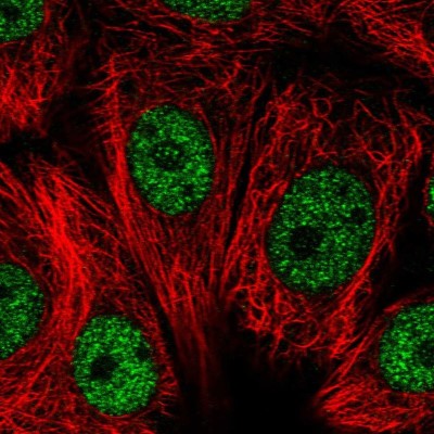 Immunocytochemistry/Immunofluorescence: RNF208 Antibody [NBP1-90501] - Immunofluorescent staining of human cell line MCF7 shows localization to nucleoplasm.