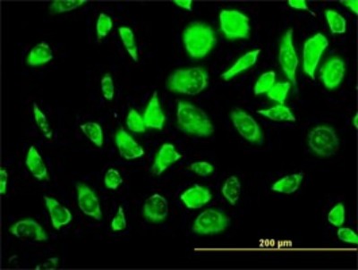 Immunocytochemistry/Immunofluorescence: RPS23 Antibody (1E3) [H00006228-M02] - Analysis of monoclonal antibody to RPS23 on HeLa cell. Antibody concentration 10 ug/ml.