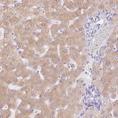 Immunohistochemistry-Paraffin: Asialoglycoprotein Receptor 2 Antibody [NBP1-85579] - Staining of human liver shows moderate cytoplasmic positivity in hepatocytes.