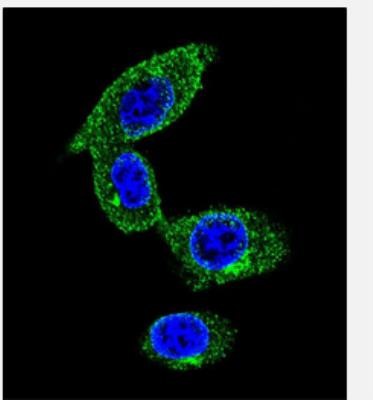 Immunocytochemistry/Immunofluorescence: SORBS1 Antibody [NBP2-29985] - MDA-MB231 cell followed by Alexa Fluor 488-conjugated goat anti-rabbit lgG (green). DAPI was used to stain the cell nuclear (blue).