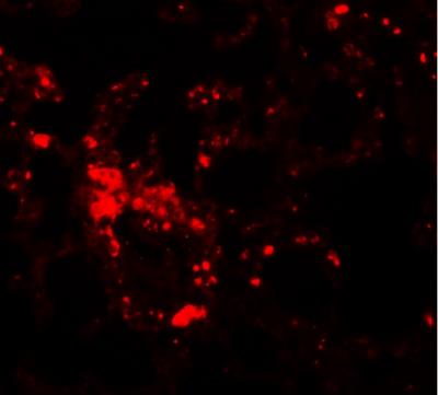 Immunocytochemistry/Immunofluorescence: LIV-1/Zip6 Antibody [NBP1-76503] - Mouse lung tissue.