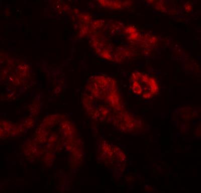 Immunocytochemistry/Immunofluorescence: DPF2 Antibody [NBP1-76512] - Immunofluorescence of DPF2 in human kidney tissue with DPF2 antibody at 20 ug/mL.