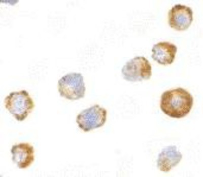 Immunocytochemistry/Immunofluorescence: ASK1 Antibody [NBP1-76674] - A431 cells with ASK1 antibody at 2 ug/ml.