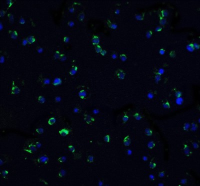 Immunocytochemistry/Immunofluorescence: DR3/TNFRSF25 Antibody [NBP1-76474] - Staining of DR3 in Jurkat cells with DR3 antibody at 5 ug/ml.