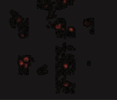 Immunocytochemistry/Immunofluorescence: MDA5 Antibody [NBP1-76761] - Immunofluorescence of MDA5 in Human Lymph Node cells with MDA5 antibody at 20 ug/mL.