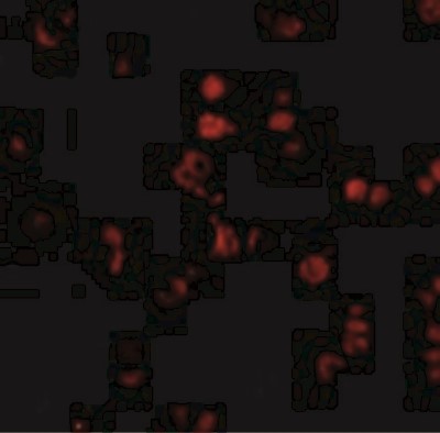 Immunocytochemistry/Immunofluorescence: AATF Antibody [NBP1-76655] - Immunofluorescence of AATF in Human Small Intestine cells with AATF antibody at 20 ug/mL.